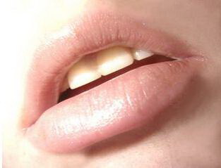 口腔粘液多有异味什么原因_口腔长期有异味是什么原因