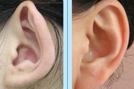 左边咬肌疼连着耳朵疼_吃什么能补耳朵内的神经