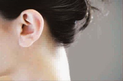 外耳中耳内耳_右侧外耳畸形耳道闭锁