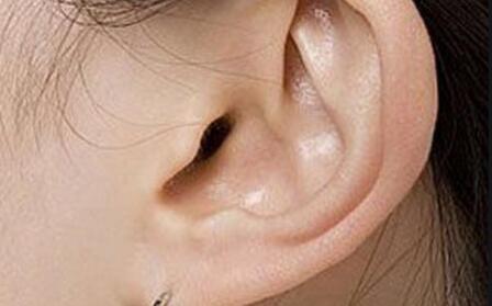 耳垂修复术