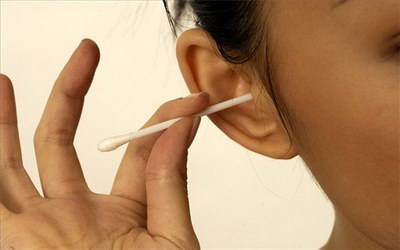 贴面耳矫正器(贴面式耳矫正器，一种方便舒适的矫正方式)