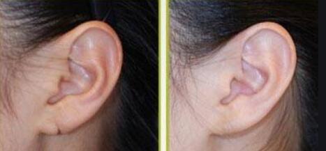 耳朵受伤怎么恢复_耳朵受伤怎么检查