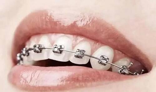 种植牙二期手术过程图解_上海种植牙私立医院排名