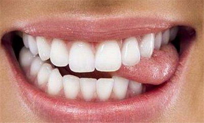正畸期间牙齿松动的厉害(正畸期间牙齿松动正常吗)