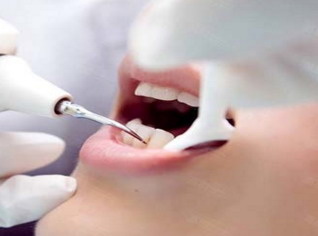 拔牙麻醉后一般多久可以完全恢复_拔牙麻醉舌头多久消失
