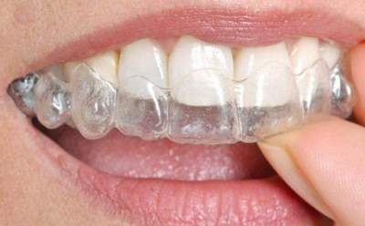 种植修复义齿_种植义齿图片