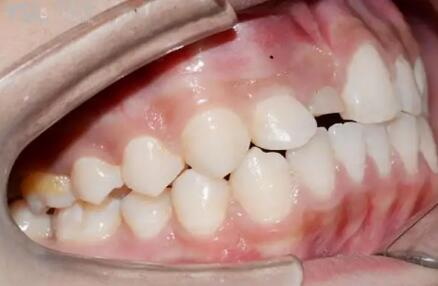 口腔补牙应该挂哪个科_口腔补牙可以走医保吗