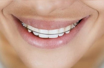 包牙齿一般可以维持多久_包牙齿有什么好处和坏处