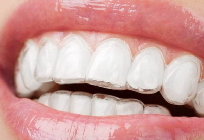 香菜能治疗牙疼吗?