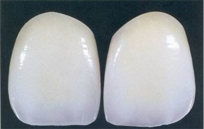 牙龈萎缩的治疗方法(苏州牙龈萎缩的治疗方法)