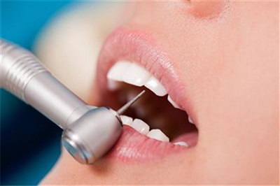 治牙痛的药有哪些_治牙周炎的四种药