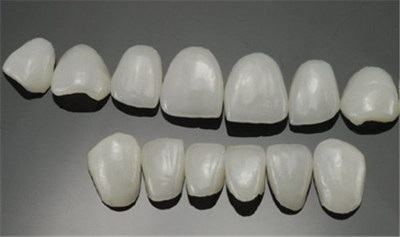 牙齿矫正托槽的过程(自锁托槽牙齿矫正过程)