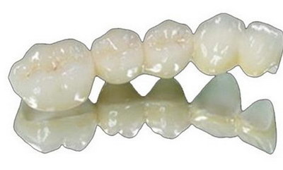 拔牙后牙窝正常是什么颜色_拔牙后牙窝白色东西是什么