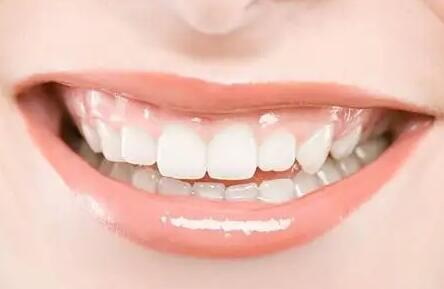 乳牙做根管治疗影响换牙吗(乳牙根管治疗会影响恒牙牙胚)