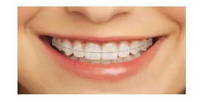 二次根管治疗有残留牙髓怎么办_根管治疗抽完牙髓为什么这么酸软