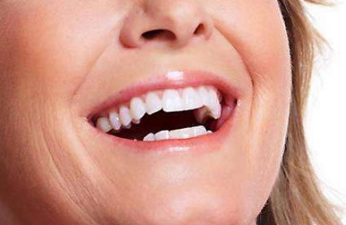 成年人矫正牙齿要拔牙4颗有危害吗_拔牙后矫正牙齿松动