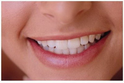 拔牙之后牙龈上有刺_拔牙后牙龈能疼多久
