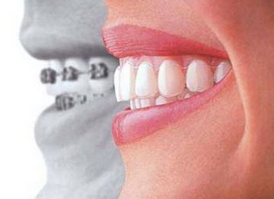 拔牙为什么要打激素_放疗几年后可以拔牙
