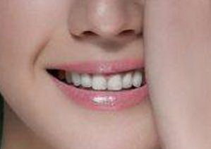 冲牙器会对牙齿造成伤害_冲牙器为什么会牙齿出血