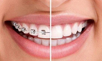 补牙后牙龈发炎怎么处理_补牙后牙龈有脓包一年了