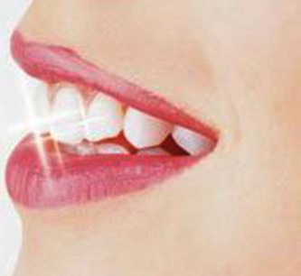 矫正完牙齿可以洗牙吗[牙齿可以只矫正单排吗]