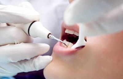 口腔牙龈出血是什么原因引起的_吃阿司匹林后牙龈出血怎么回事