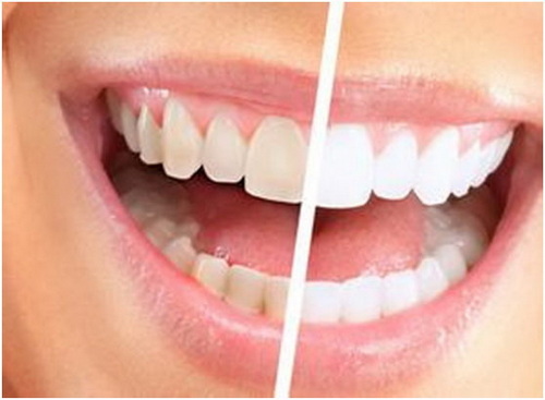 复合树脂修复牙齿_复合树脂修复牙齿步骤