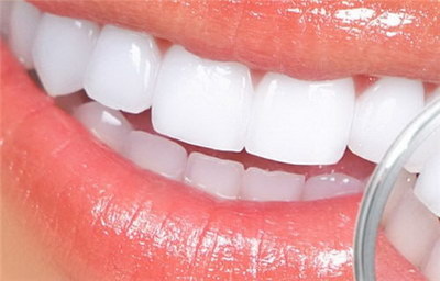 大人牙齿涂氟管用吗(什么是大人牙齿涂氟管？)