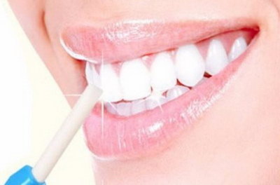 可以美白牙齿的漱口水_光固化美白牙齿安全吗