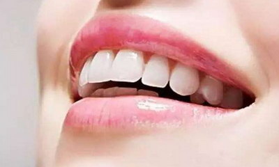 龅牙矫正牙齿需要带什么_龅牙矫正牙齿的全部过程