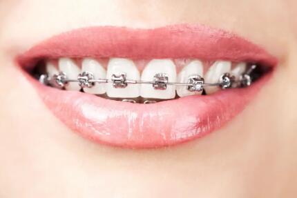 刷牙为什么老是牙龈出血_刷牙可以预防牙龈出血吗