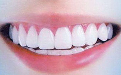 刷牙一个牙齿经常出血_刷牙怎样牙齿才能变白