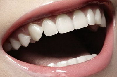 大人牙齿突然变稀了怎么回事_大人牙齿突然变成黑色是什么原因