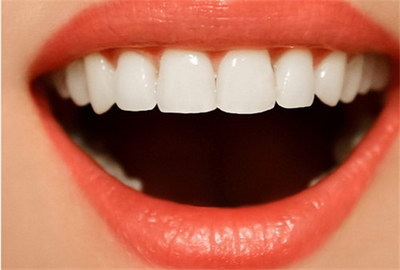 成人矫正牙齿后黑三角_成人矫正牙齿多长时间