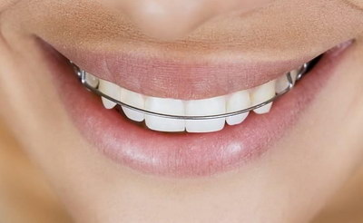 补牙树脂是什么材料做的_补牙树脂有哪些牌子的 进口