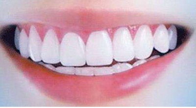 还没有换的牙齿叫什么齿_地中海贫血会影响牙齿吗