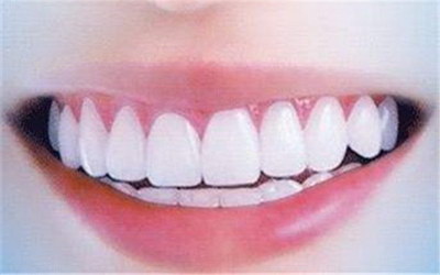 根管治疗后的牙齿敲击痛的原因_根管治疗牙齿填充物是什么材料