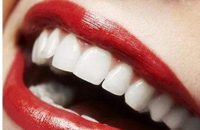 全瓷牙可以美白牙齿吗_去牙垢美白牙齿的东西