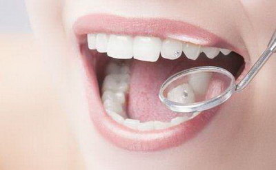 拔牙后怎么止住口腔内的血水_拔牙后可以吃酸奶清洗口腔吗