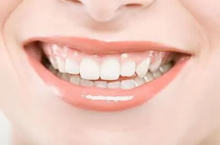 前牙指的是哪些牙齿_前牙蛀牙不容易发现
