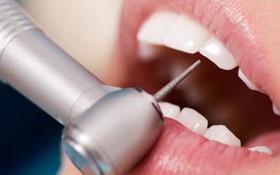 做完根管治疗后牙齿痛_全瓷牙根管治疗是什么
