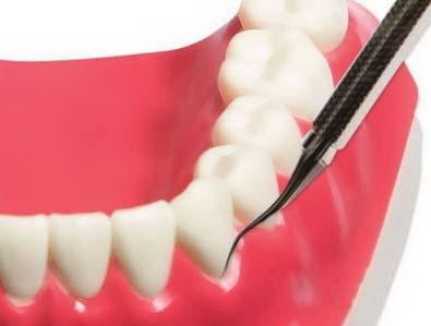 牙神经杀死后牙齿很臭(使用牙神经治疗后牙齿出现异味怎么办？)