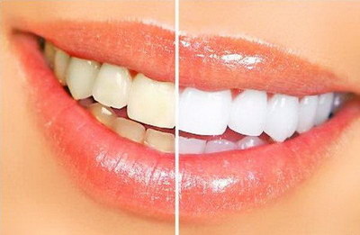 怎样让牙齿变白科学方法_怎样让牙齿变得更白日常