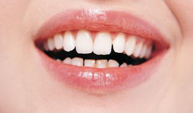 拔牙矫正牙齿能收进去多少_拔牙矫正牙齿能有什么变化