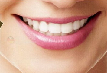 全口义齿上颌基托伸展范围_全口义齿平衡颌包括哪几种