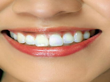刷牙时牙龈老是出血怎么治疗_刷牙牙龈偶尔出血是什么原因