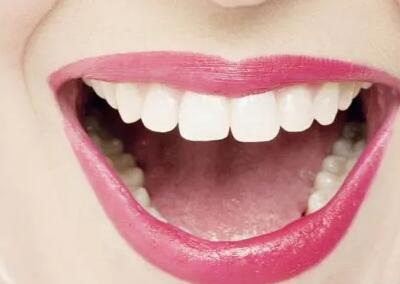 口干口苦牙龈出血是什么原因_吃拜阿司匹林牙龈出血怎么办