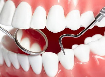 用什么能让牙齿快速变白(5个让牙齿快速变白的方法)