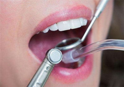 全瓷牙牙可以用多久_全瓷牙牙能使用多久
