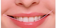 牙周炎会导致牙齿酸痛吗(牙周炎的症状)